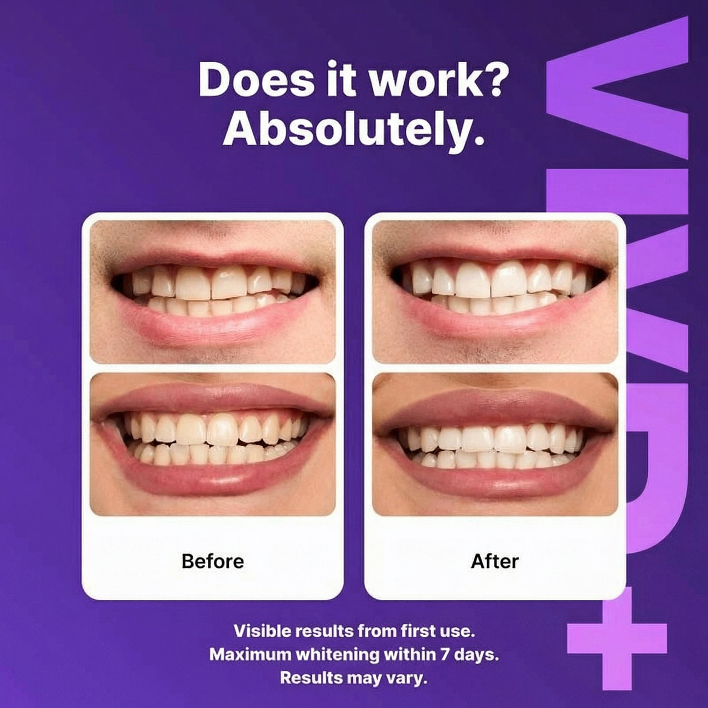 VIVD+ Purple Whitening Strips